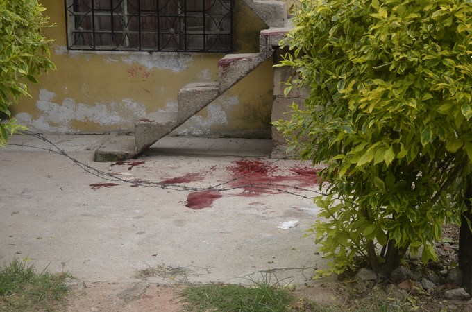 Ataque sicarial en Barbosa deja una persona gravemente herida. Fotos 1 Foto: Guillermo Naranjo