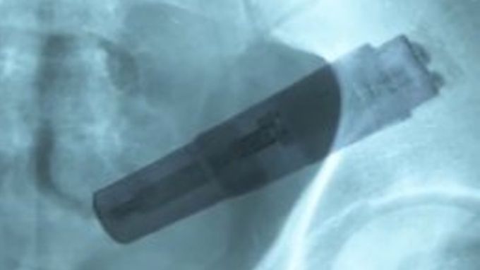 vibrador en el intestino app