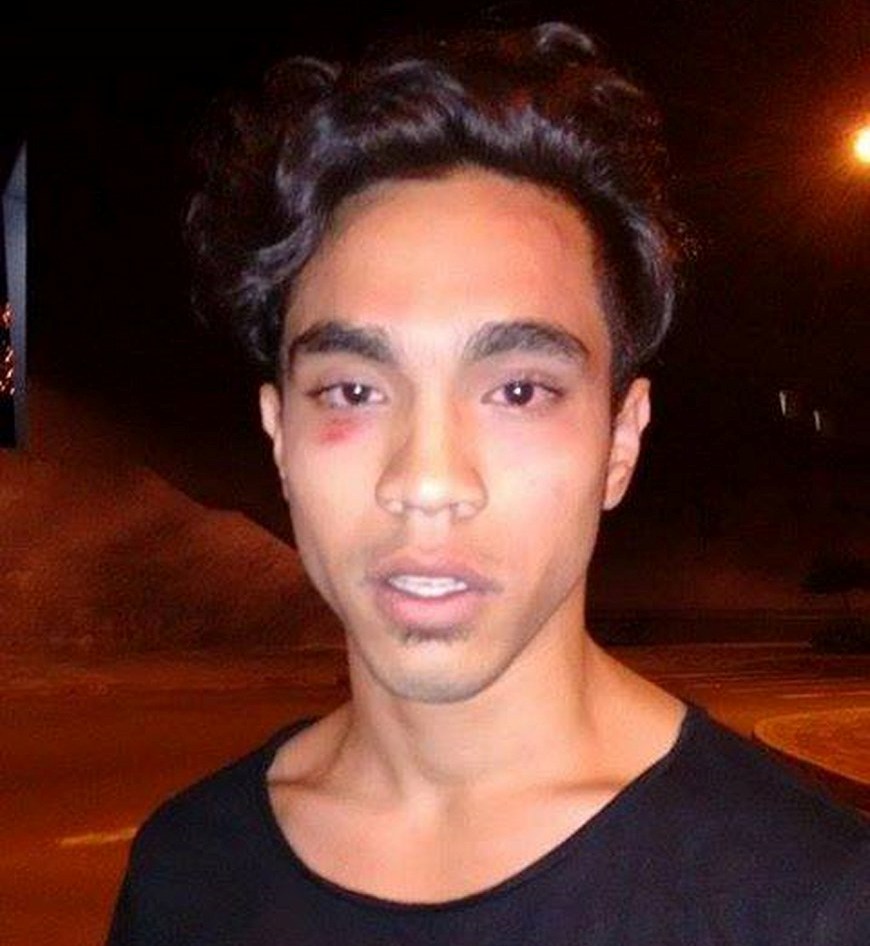 Edwin Carvajal, la noche de la agresión. Foto: Cortesía