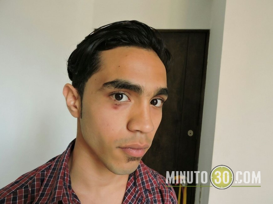 Edwin Carvajal, joven agredido.