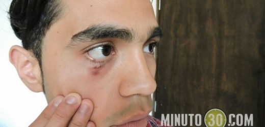 En video: Jóvenes denuncian agresión policial en el Parque Bicentenario