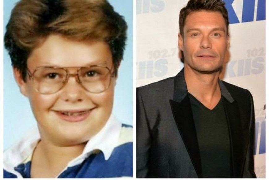 el-antes-y-despues-Ryan Seacrest (Copiar)