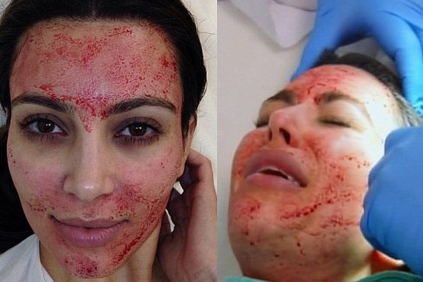 kim-sangre-en-rostro (Copiar)