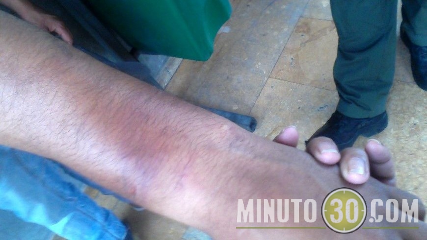 Imágenes de la agresión.