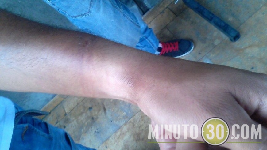 Imágenes de la agresión.