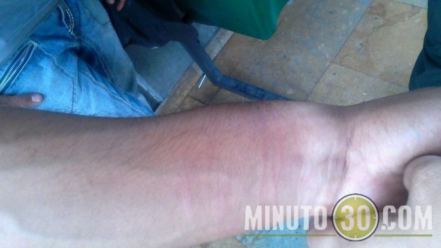 Imágenes de la agresión.