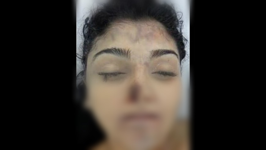 Cadáver de Kelly Johana Úsuga Matto. Foto: Cortesía