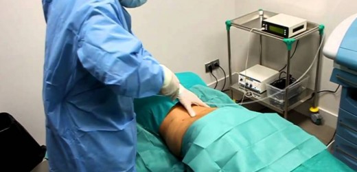 Judicializados médico y dos enfermeras por muerte de paciente a la que le hicieron la lipo