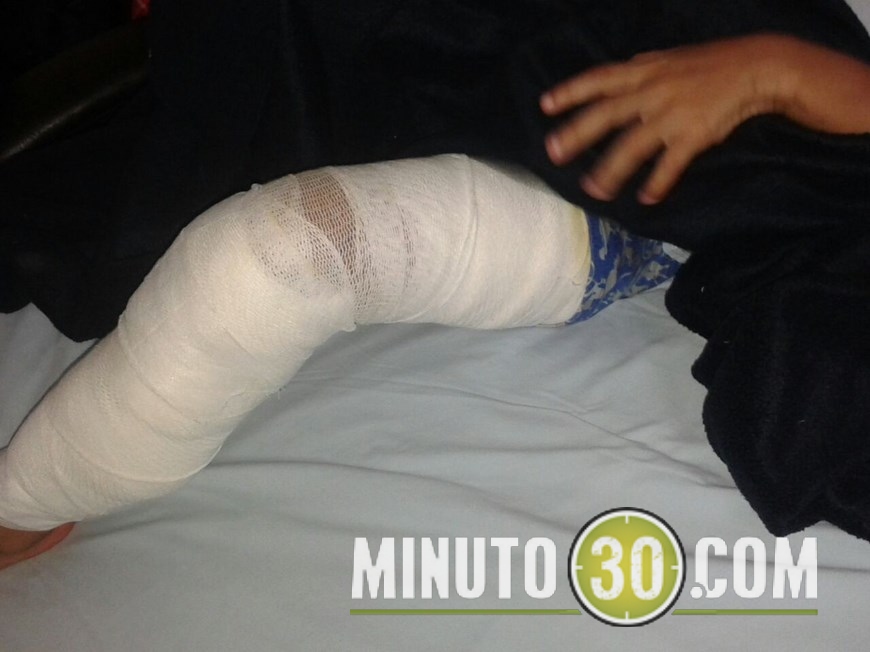 niño mordido por perro (1)(1)