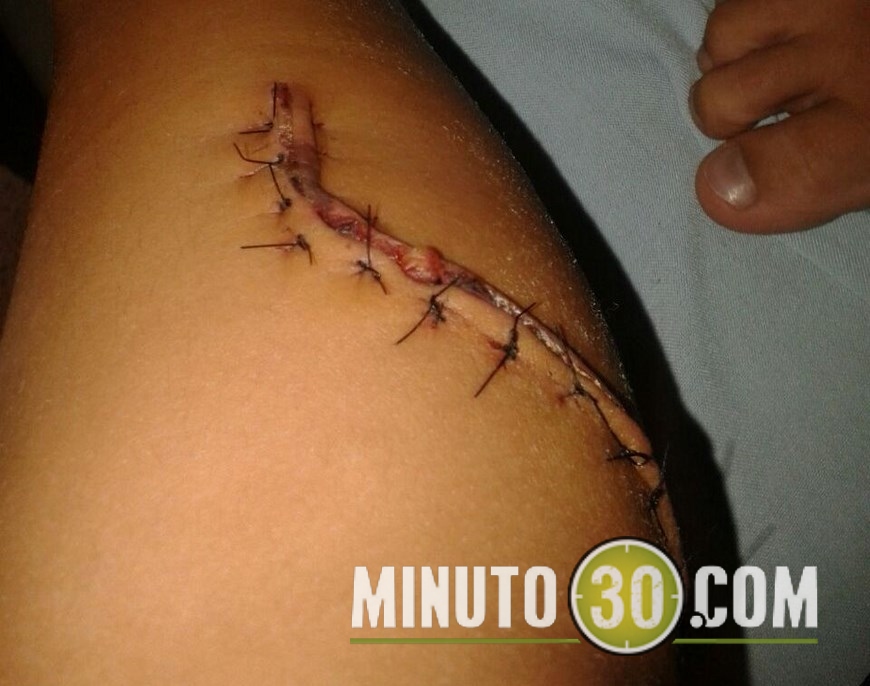 niño mordido por perro (3)(1)