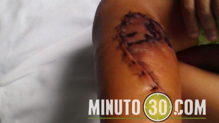 niño mordido por perro app(1)