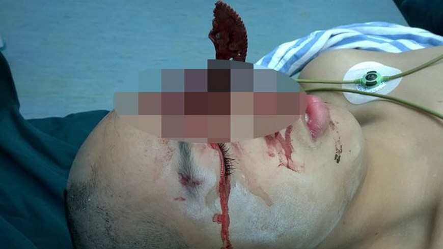 Sierra en la Cabeza 1