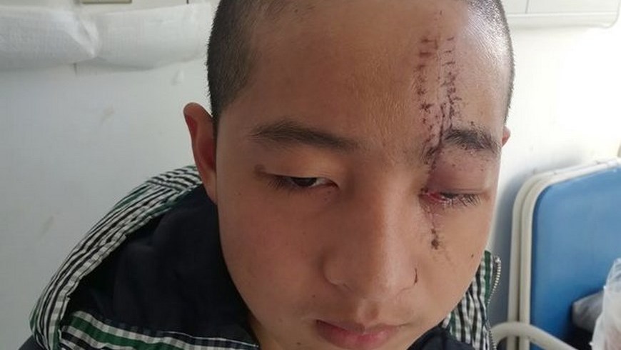 Sierra en la Cabeza 2