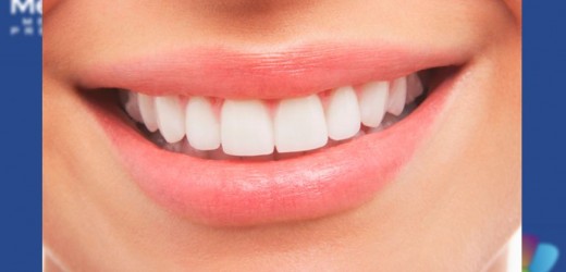 dientes med plus