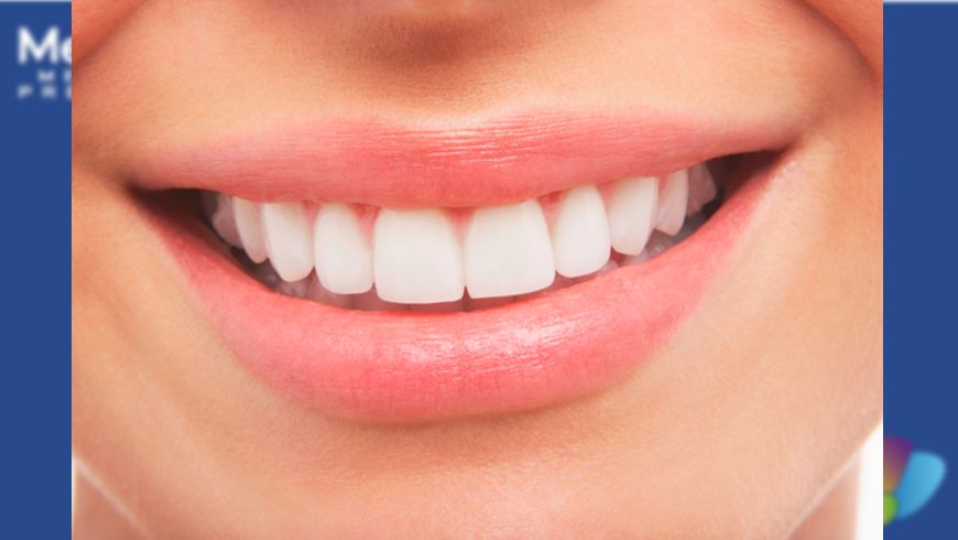 Prótesis dentales, ¿cómo cuidarlas? 4 dientes med plus
