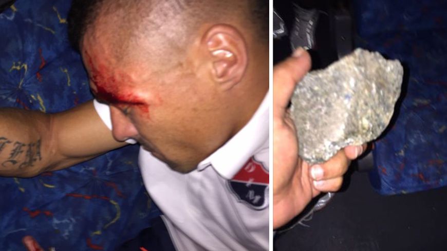 FOTOS: Herido Vladimir Marín en ataque de hinchas del Tolima al bus del DIM 3 vladimir1