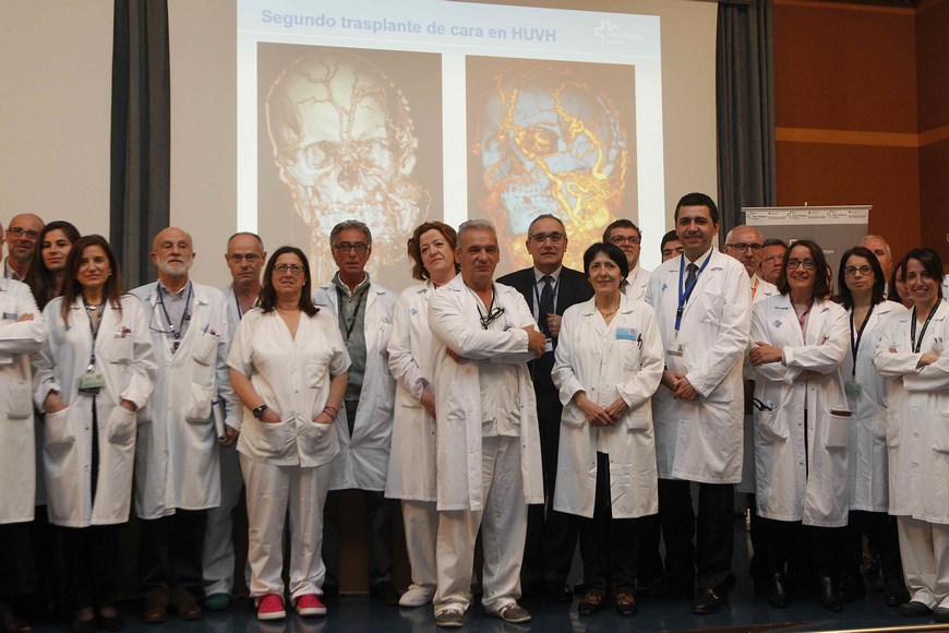 El equipo multidisciplinario de 45 profesionales del Hospital Universitario de la Vall d'Hebron de Barcelona, que realizó la intervención. EFE