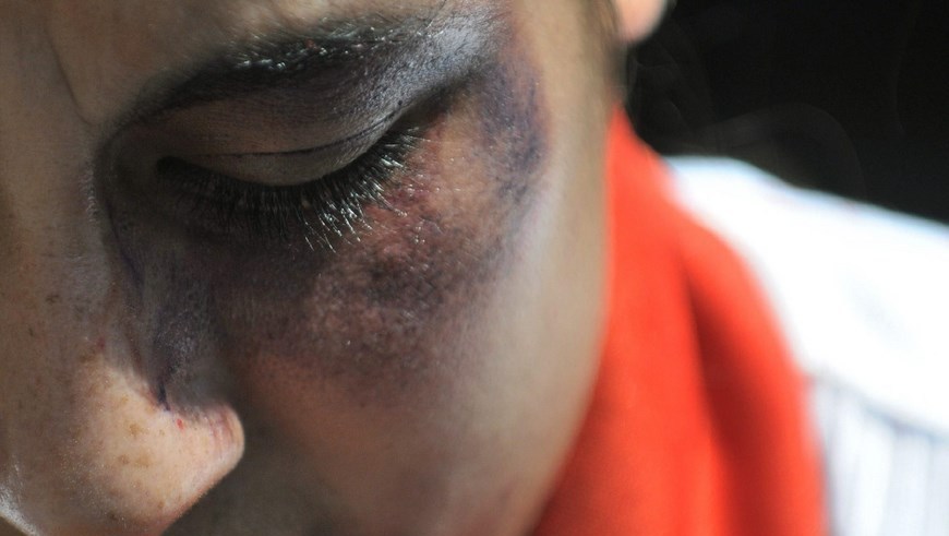 Juristas, mujeres maltratadas, vilonecia, violencia contra la mujer