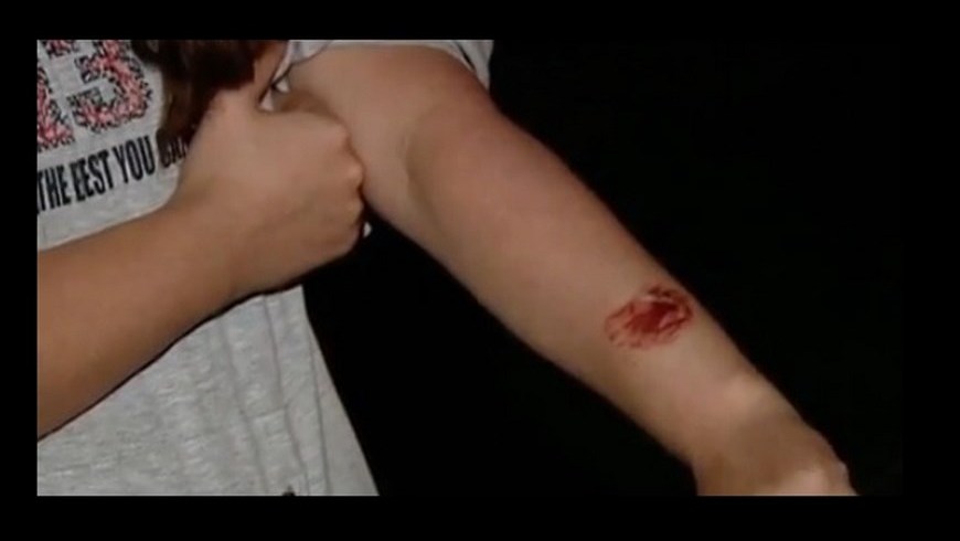 LA MORDIERON EN TRANSMILENIO (1)