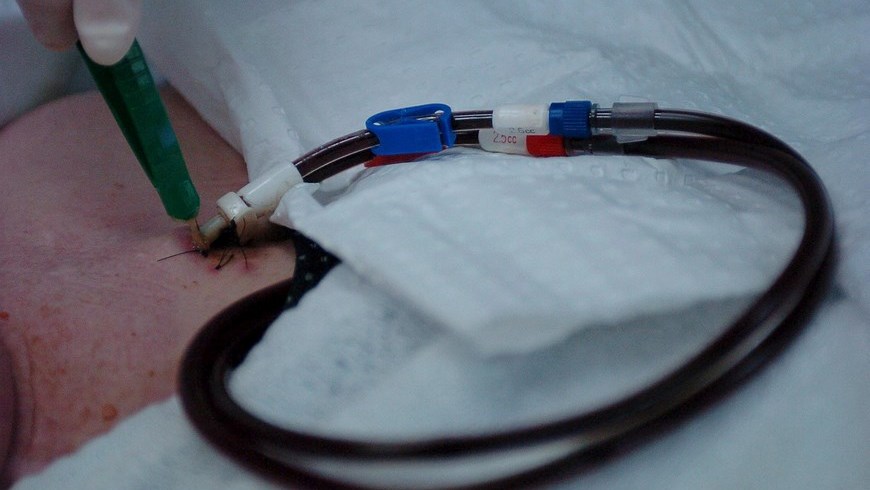 Sangre,medicos,transfucion