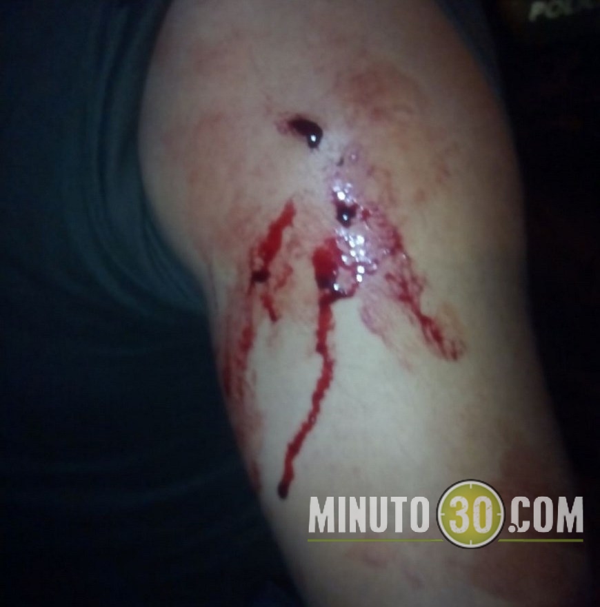 La herida provocada al uniformado de la Policía.