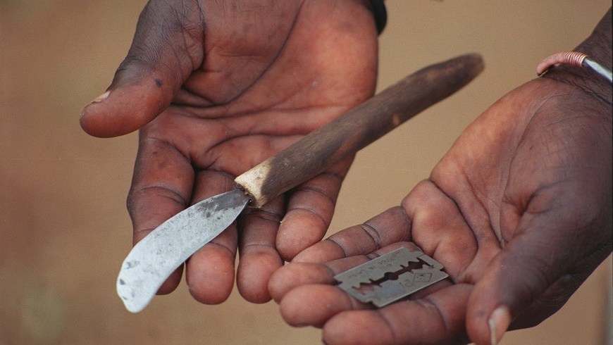 Mutilacion Femenina