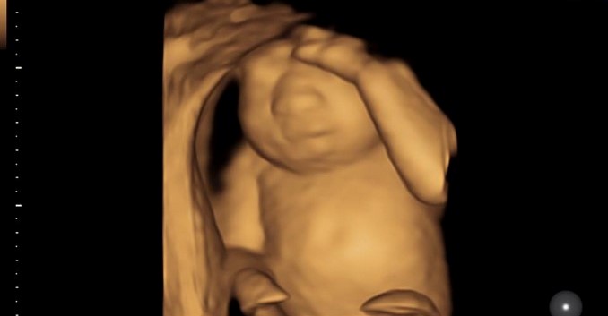 eva bebe donacion de organos