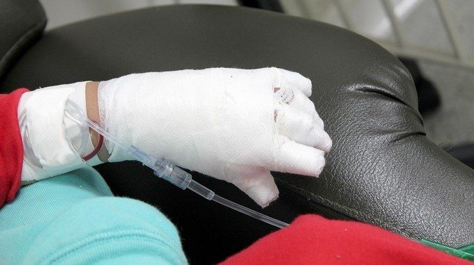 quemados, quemaduras