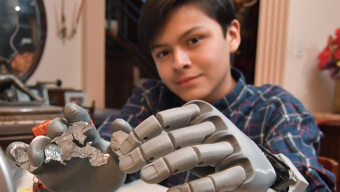 Fotografía del 17 de enero de 2017, de Leonardo Viscarra quien trabaja en una mano robótica en Cochabamba (Bolivia). EFE