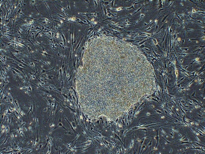 Realizan en Japón el primer trasplante en humanos con células iPS de donante 2 celulas IPS