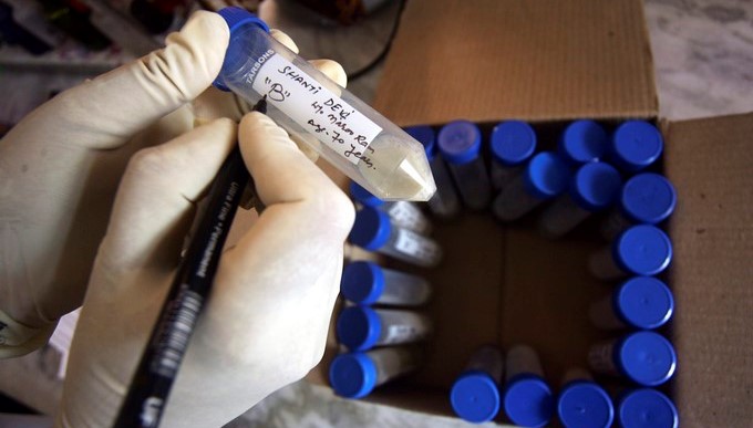 Un trabajador sanitario recoge una muestra de un paciente enfermo de tuberculosis en un hospital. Los casos nuevos de tuberculosis en el continente han disminuido un 1,8 % anualmente y las muertes un 2,9 % en 2015, aunque casi 9 de cada 10 casos se concentran en 10 países, entre los que destacan Brasil, Perú, México y Haití. EFE/Archivo