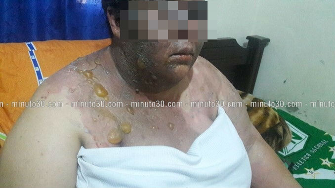 Mujer_Agredida_nueva_1