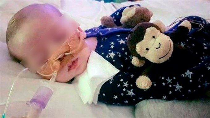 Charlie Gard tiene ocho meses y fue diagnosticado con el síndrome de agotamiento mitocondrial. Foto: PA