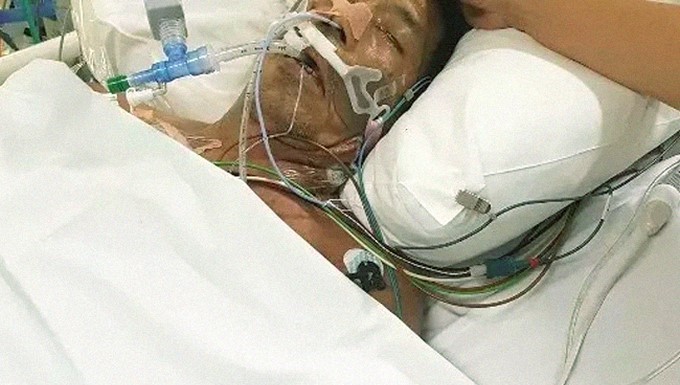 Terry Pareja, filipino mordido por una araña/ Tomada de BuzzFeed