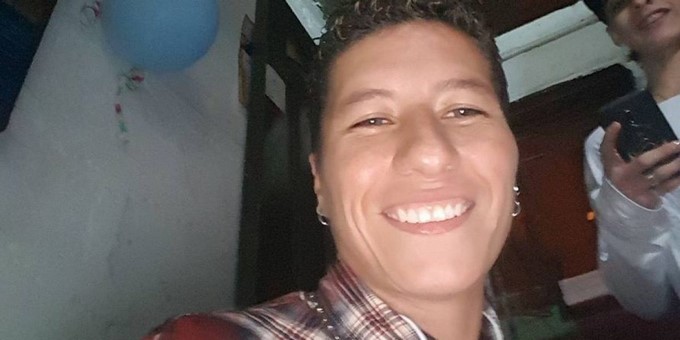 Así le quedó la nariz a la verdadera “Vendedora de Rosas” tras la cirugía