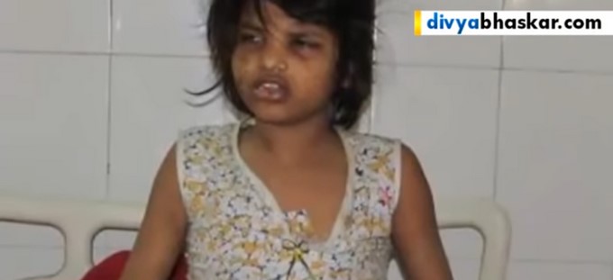 Niña "Mowgli"/ Captura tomada de Youtube: divyabhaskar