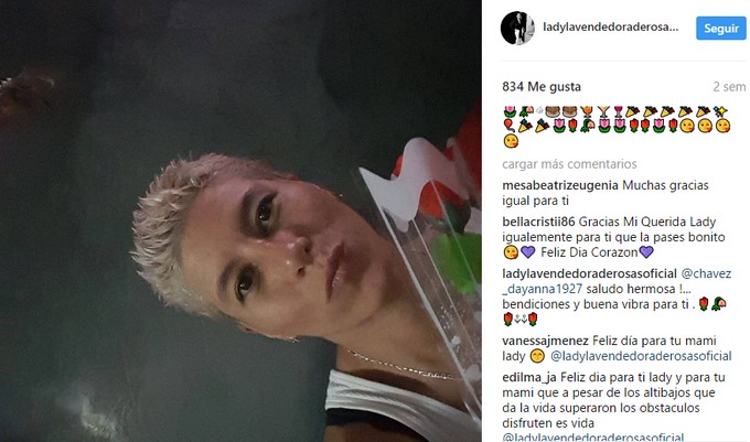 Lady Tabares tras la cirugía/ Tomada de Instagram: @ladylavendedoraderosasoficial