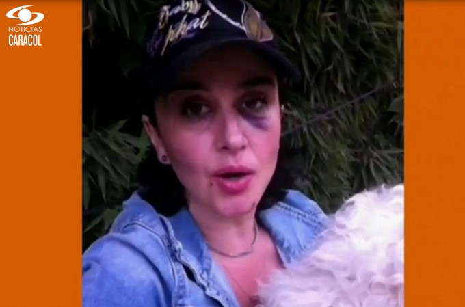 Tania Robledo golpeada en México/ Captura tomada de Caracol Noticias