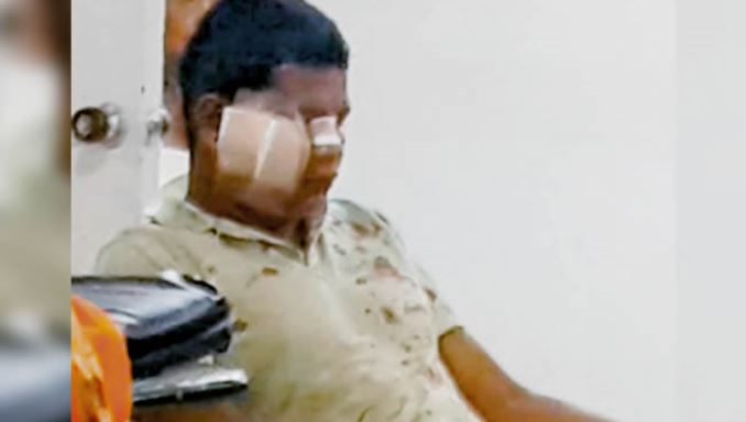 Le propinó un machetazo a joven con discapacidad mental porque le jugó una broma