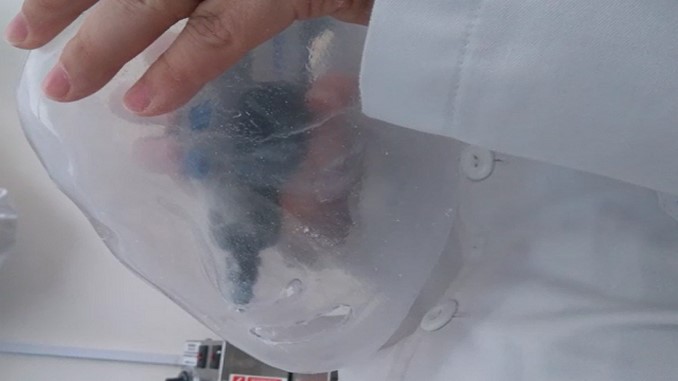 Así diseñan las máscaras transparentes para quemados en el Hospital Simón Bolívar