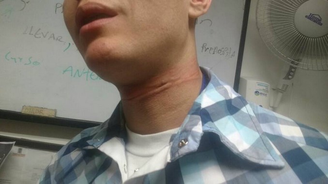 Ciudadano_Asaltado_Madre_Laura