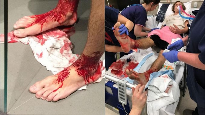 EN VIDEO: Extrañas criaturas marinas atacaron a un joven