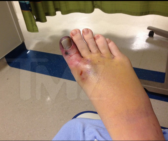 Christina Fish demanda a Katy Perry por la pérdida de su dedo/ Captura de imágenes tomada de TMZ