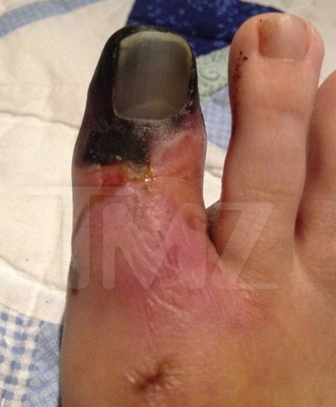 Christina Fish demanda a Katy Perry por la pérdida de su dedo/ Captura de imágenes tomada de TMZ