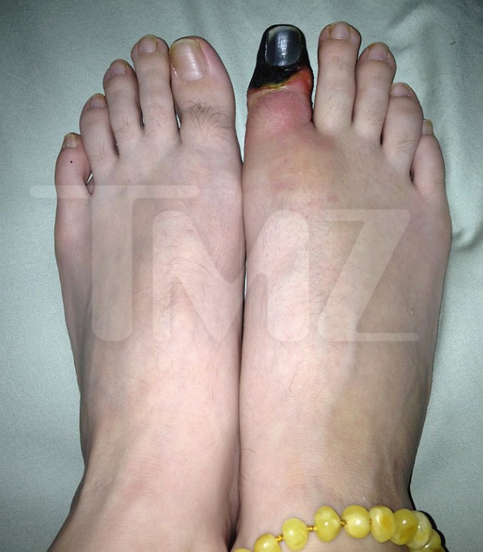 Christina Fish demanda a Katy Perry por la pérdida de su dedo/ Captura de imágenes tomada de TMZ