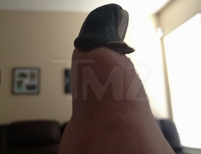 Christina Fish demanda a Katy Perry por la pérdida de su dedo/ Captura de imágenes tomada de TMZ