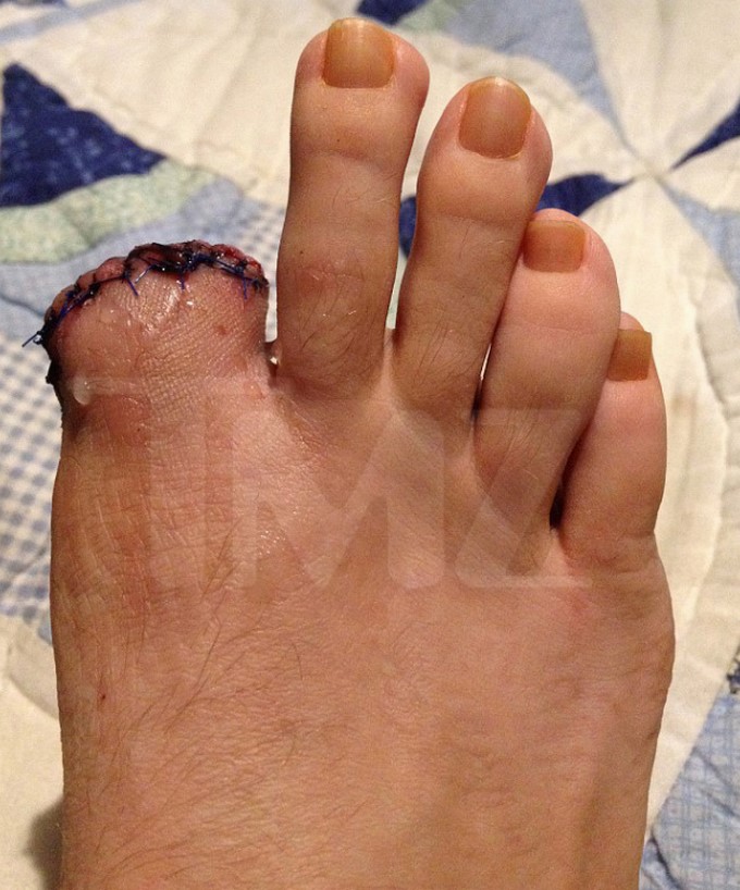 Christina Fish demanda a Katy Perry por la pérdida de su dedo/ Captura de imágenes tomada de TMZ