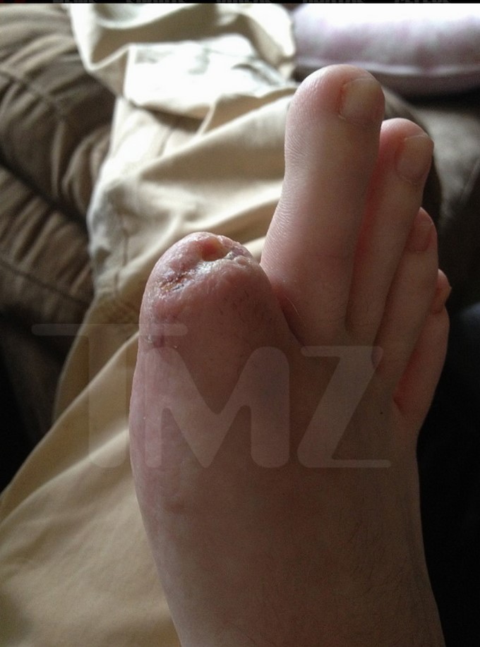 Christina Fish demanda a Katy Perry por la pérdida de su dedo/ Captura de imágenes tomada de TMZ