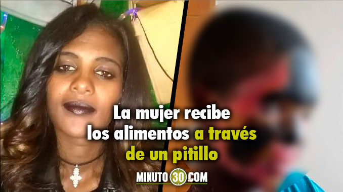 FOTOS: Así quedó luego que el esposo la bañara con ácido