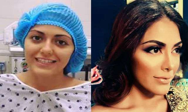 Antes y después de Alisson Abarca/ Tomada de Facebook: Miss El Salvador